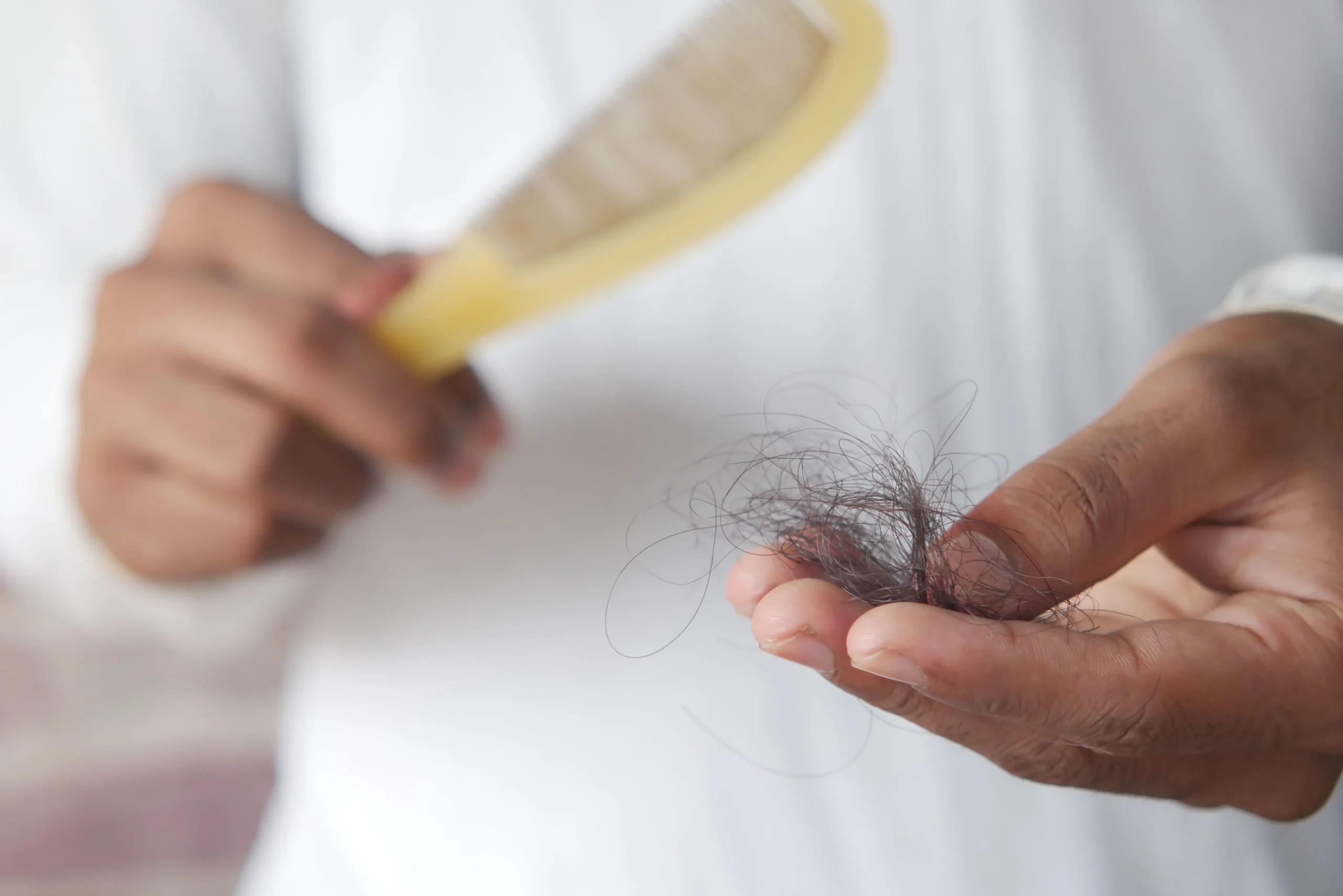 - The Color Bar, TX A person holding a clump of shed hair and a hairbrush, reflecting a need for non-surgical hair replacement in Montgomery, TX. - The Color Bar, TX